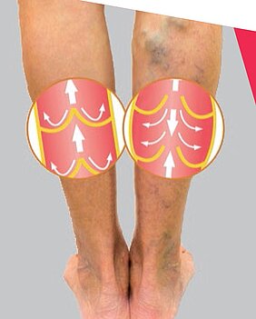 13 marzo 2019 - Rispetto della salute e malattie della circolazione